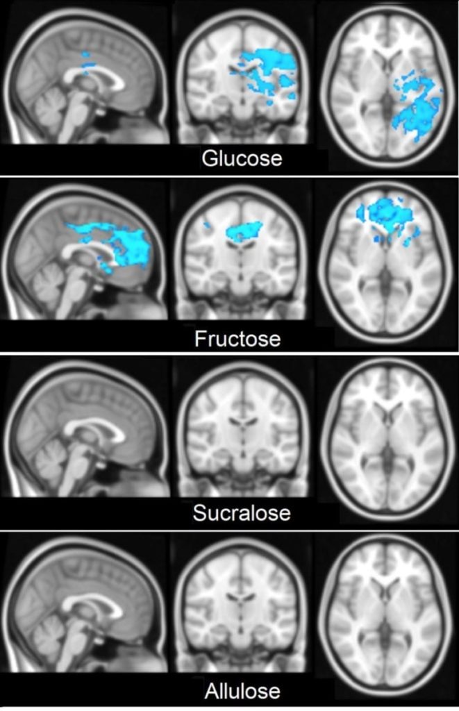 代糖-砂糖-大腦訊號-brain-reaction
